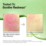 Anua Azelaic Acid 10 Hyaluron Redness Soothing Serum 30 ML - Image 3